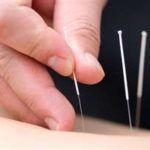 acupuncture near highlands ranch, dr adam graves