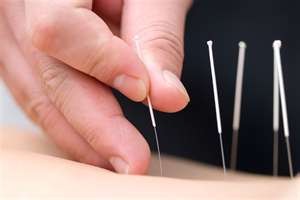 acupuncture near highlands ranch, dr adam graves
