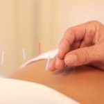 Acupuncture for Infertility, Highlands Ranch, dr adam graves