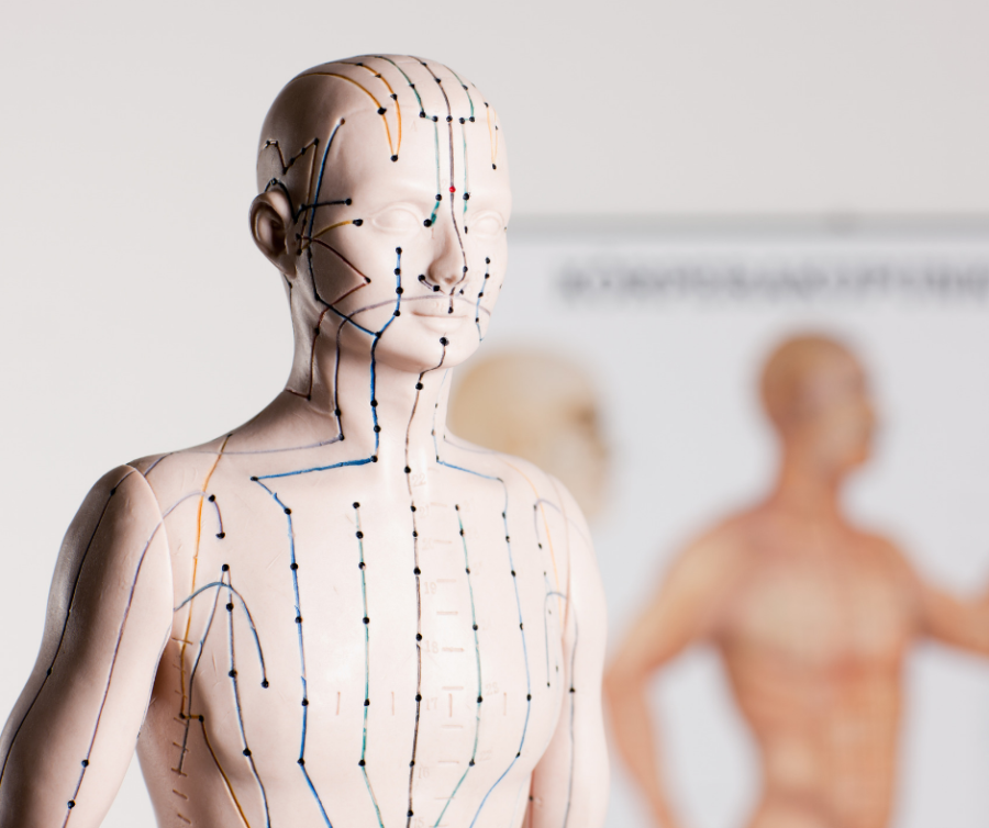 What is Acupuncture Colorado Natural Medicine